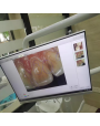 Dentalisches WLAN All-in-One-Intraorale Camera mit 24-Zoll-Touchscreen